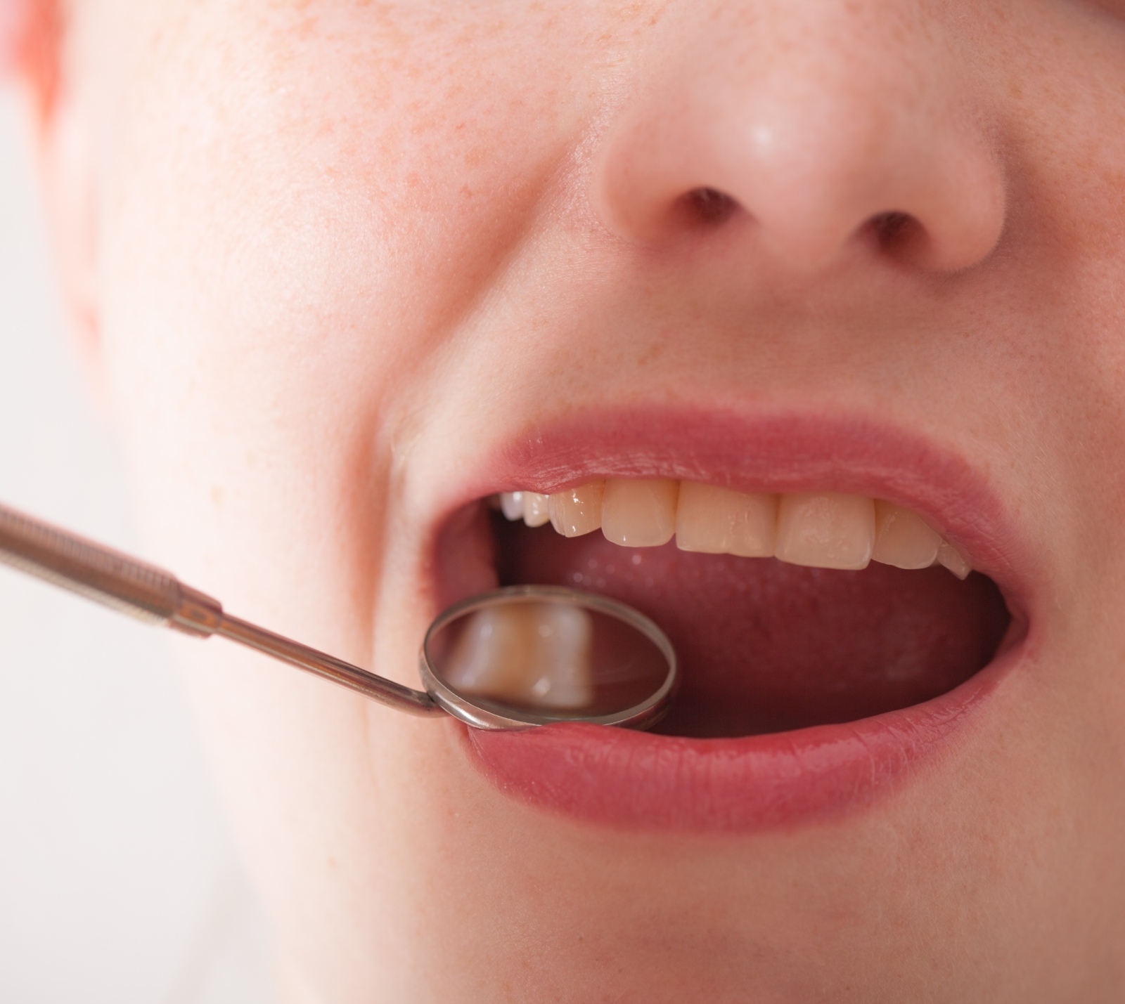 Open Mouth Woman Dentist Mirror During