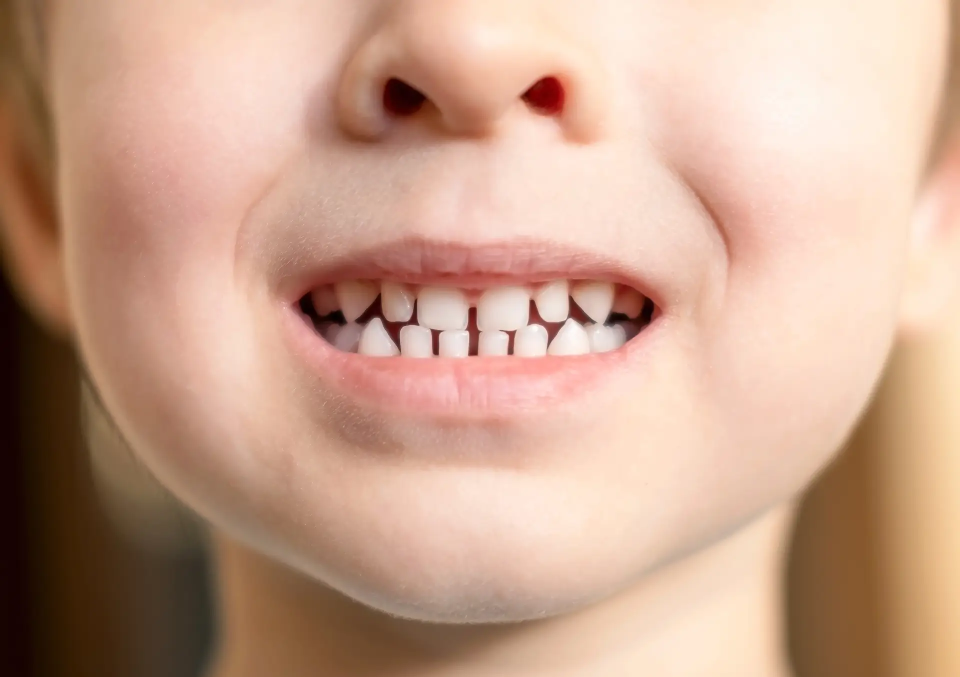 Key Differences Between Baby and Adult Teeth