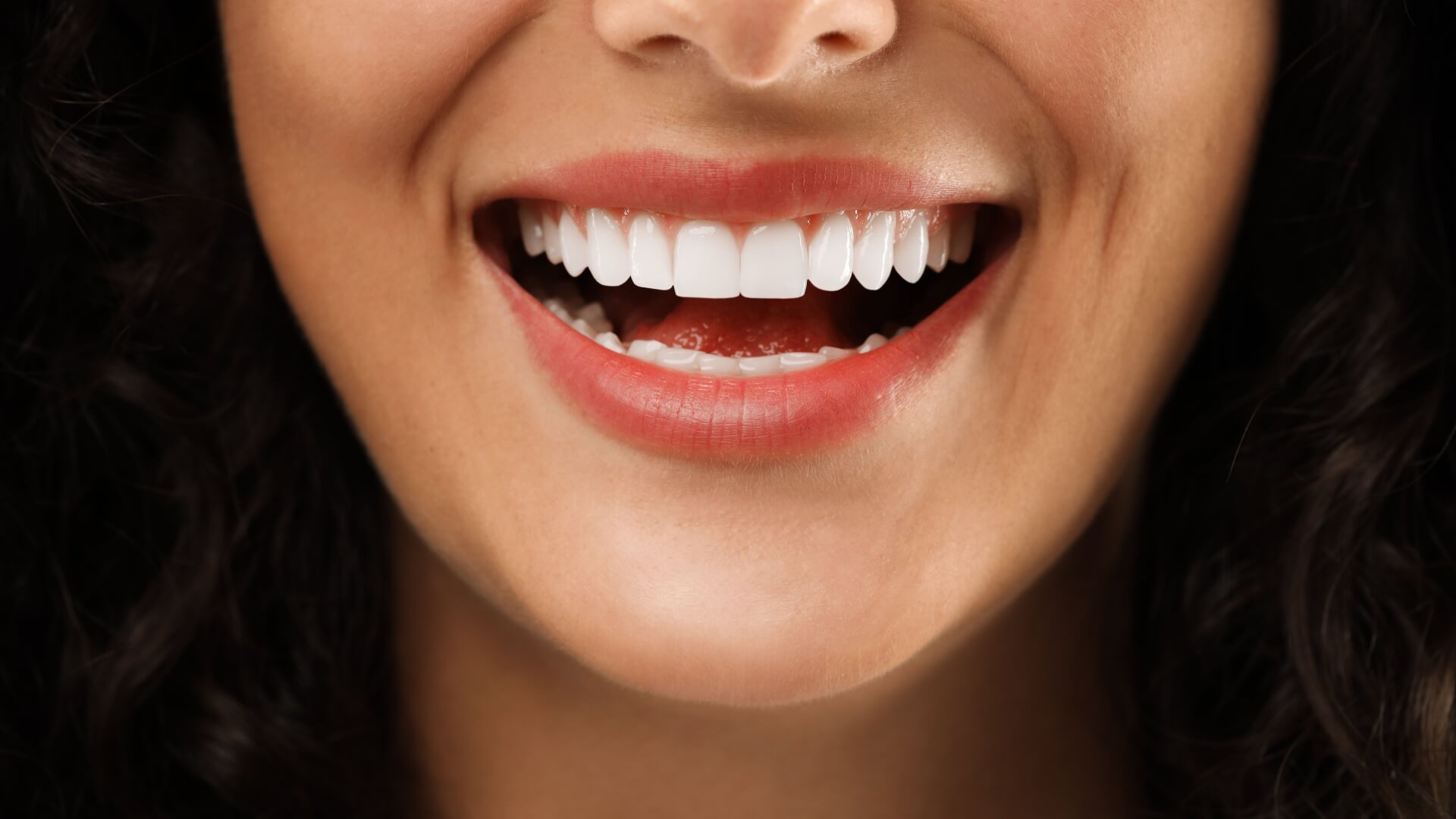 dental crowns and bridges