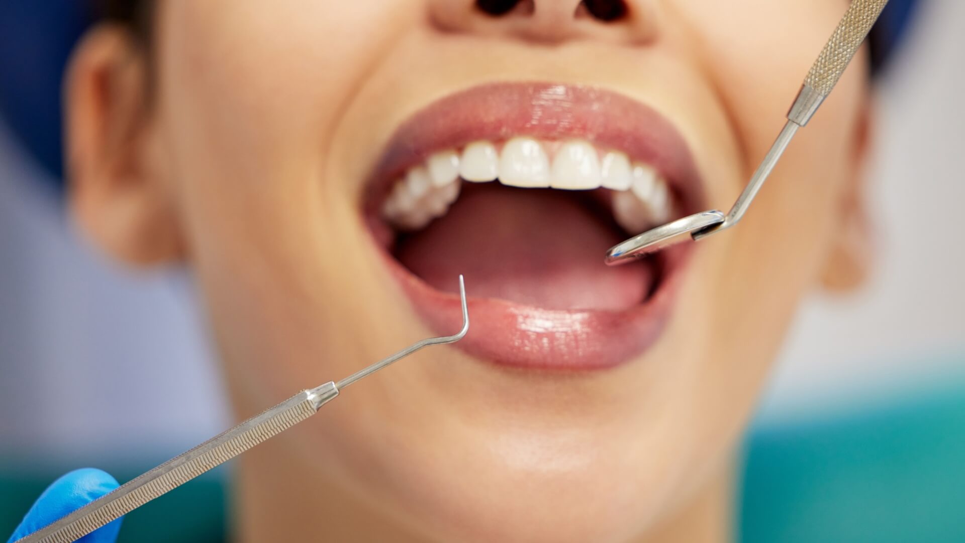 oral hygiene