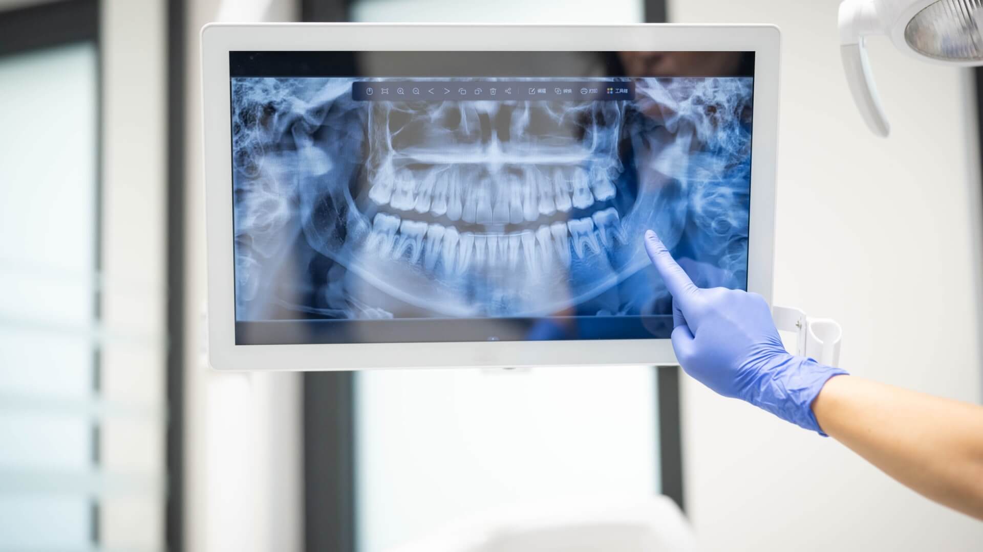 teeth x-rays