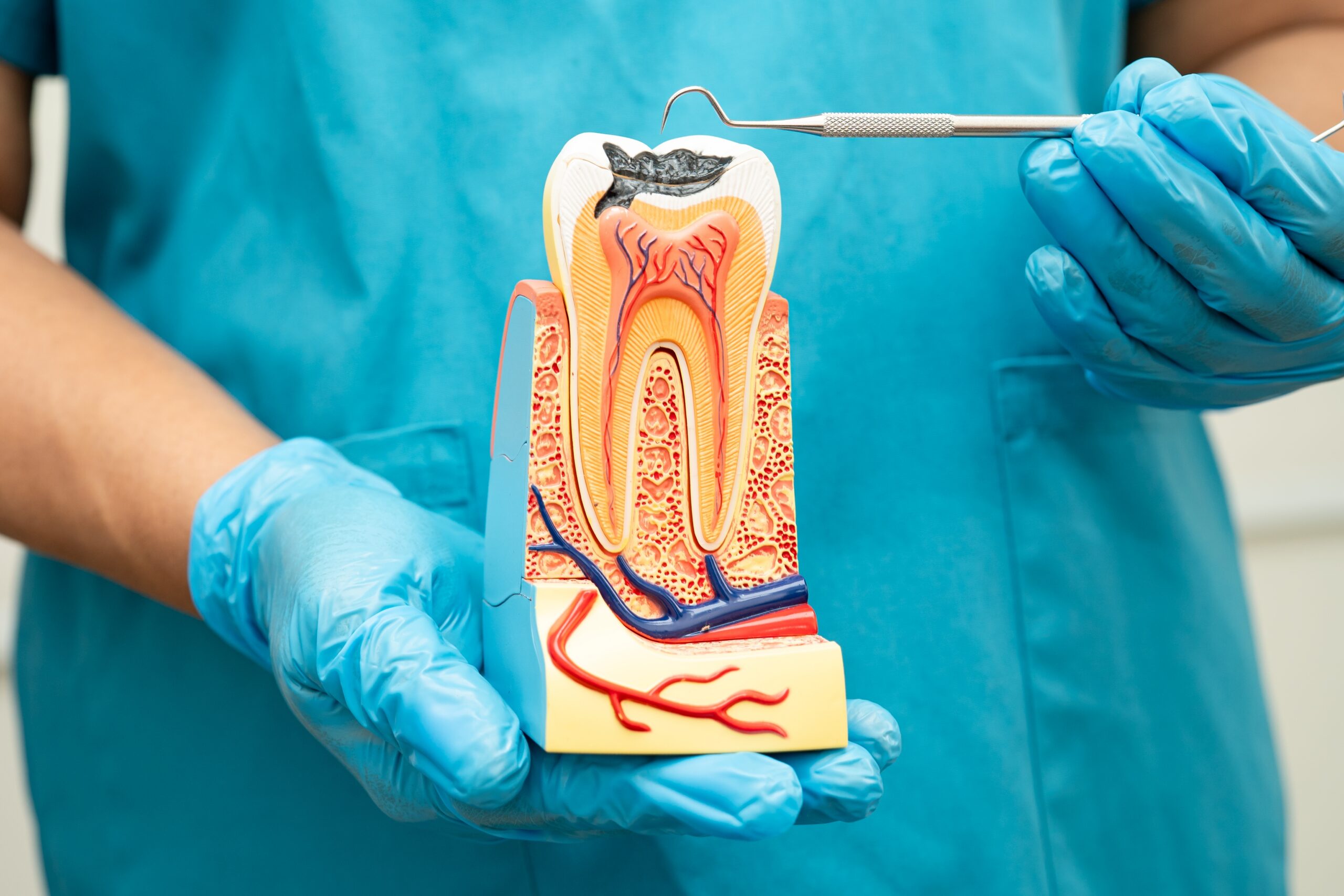 Signs You Might Need a Root Canal (and Why It’s Not as Scary as It Sounds)